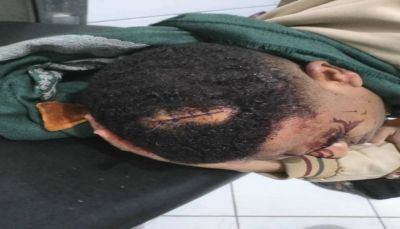  نقابة الصحفيين تدين الاعتداء المروع على مراسل "سهيل" في تعز