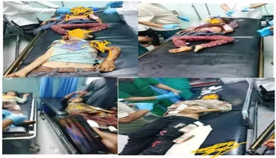 الضالع.. استشهاد 4 أطفال وجرح 9 آخرين بانفجار مقذوف حربي