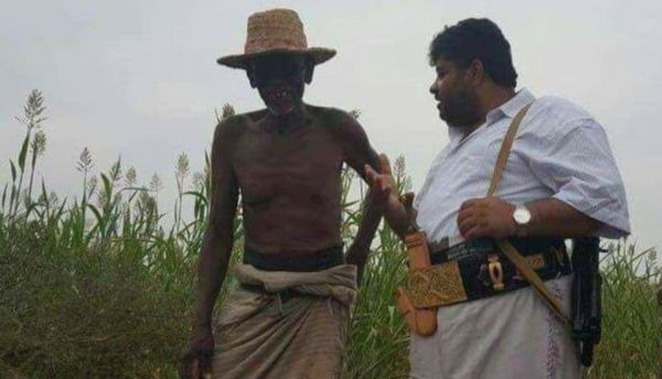 اليمن في المرتبة السادسة ضمن أخطر بؤر الجوع عالميًا