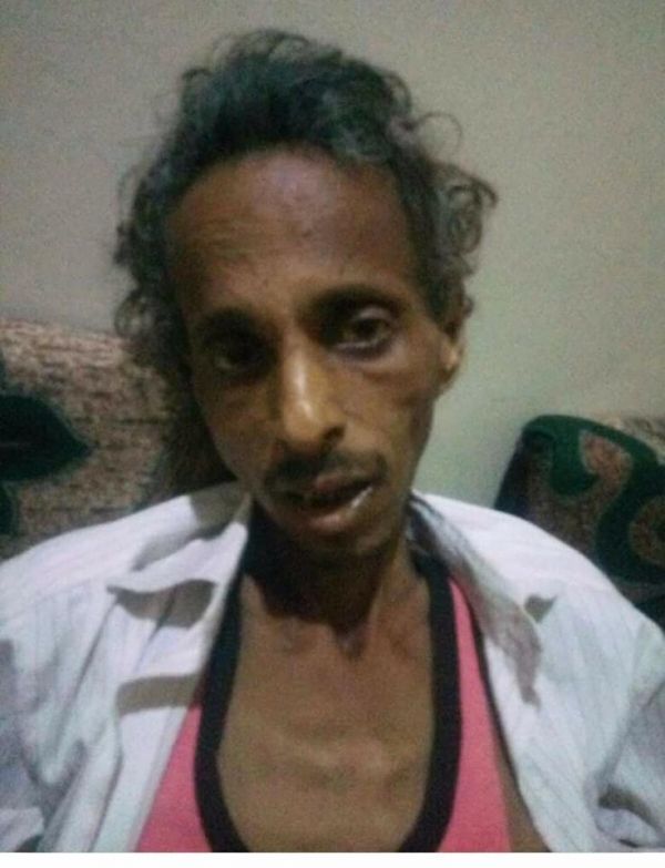 وفاة ناشط صحفي بعد تعرضه للتعذيب في سجون الحوثيين بـ"تعز"
