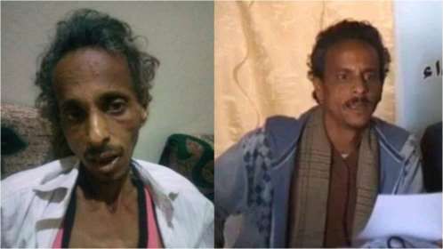 حقوق الإنسان تحمل مليشيات الحوثي مسؤولية وفاة الصحفي "الركن"جراء التعذيب