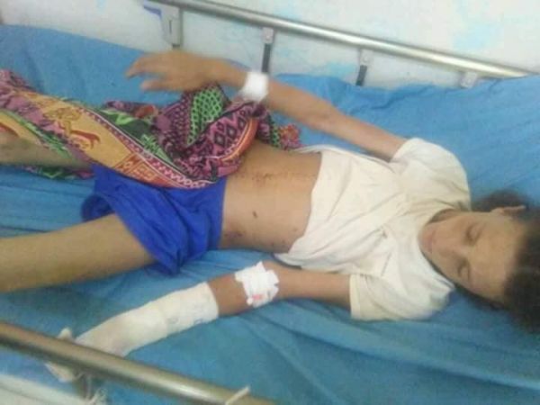 سقوط شهداء وجرحى مدنيين في مجزرة ارتكبتها مليشيات الحوثي غرب مريس