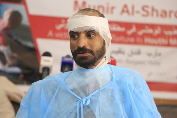 شهود وأطباء يكشفون وقائع التعذيب الوحشي للمختطف "الشرقي" في سجون الحوثيين