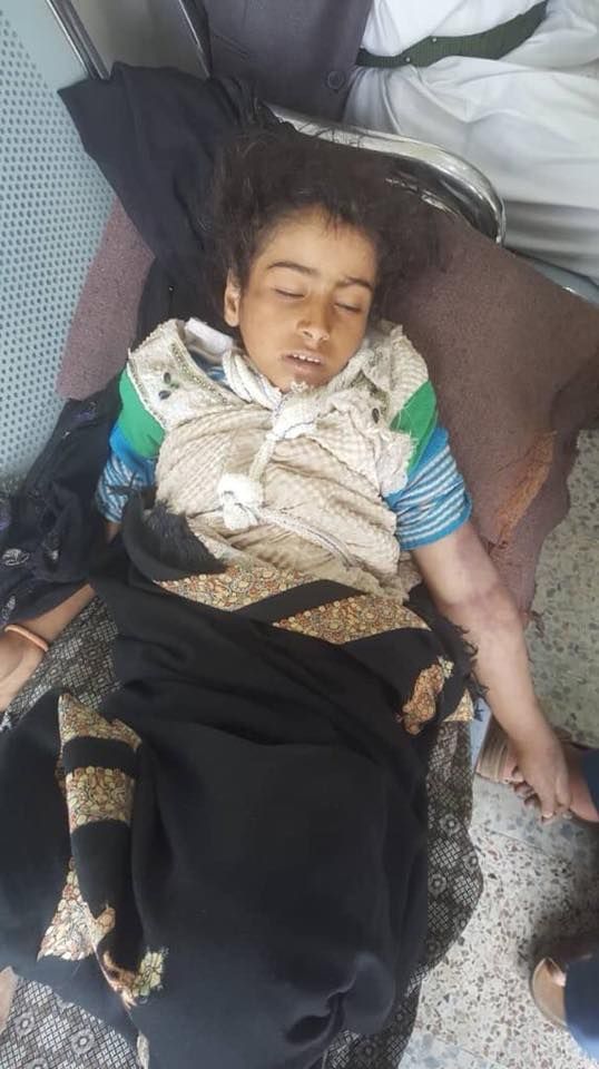  جريمة جديدة تهزّ العاصمة.. مقتل طفلة على يد والدها بـ"صنعاء" (اسم وصورة)
