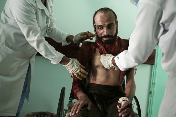 وكالة اسوشيتد برس تكشف جرائم الحوثيين بحق المختطفين اليمنيين (ترجمة خاصة)