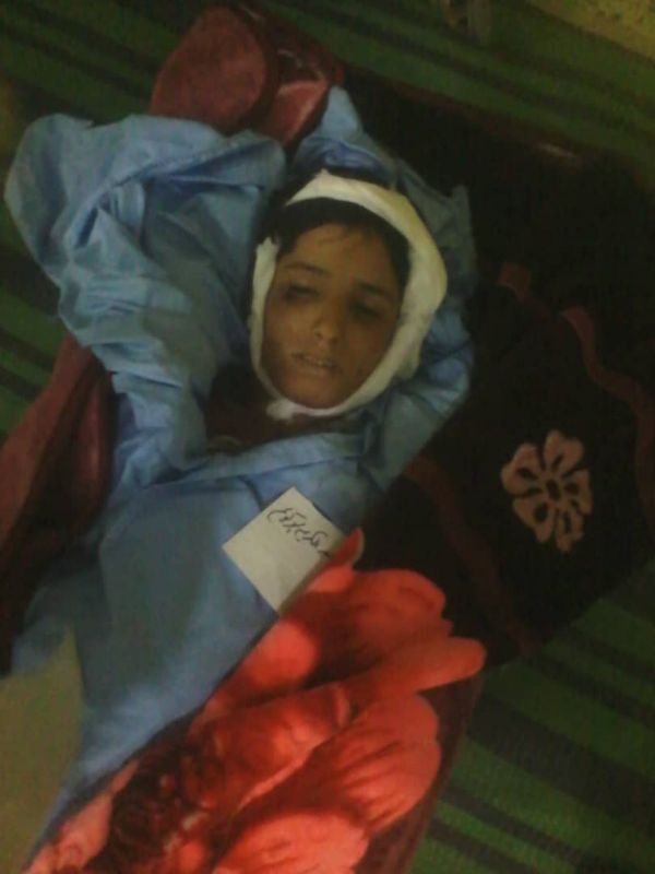 مقذوف حوثي يودي بحياة طفلين وجرح 15 آخرين بهمدان شمال صنعاء