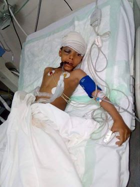  مقتل طفل برصاص مليشيا الحوثي بصنعاء