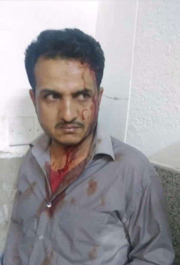صنعاء.. مليشيا الحوثي تعتدي على طبيب في مستشفي الثورة العام