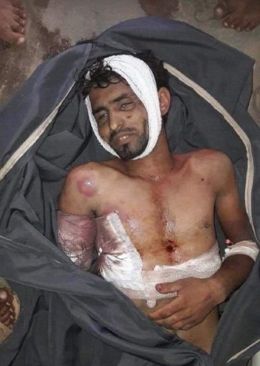 وفاة مختطف جديد تحت التعذيب في سجون الحوثيين
