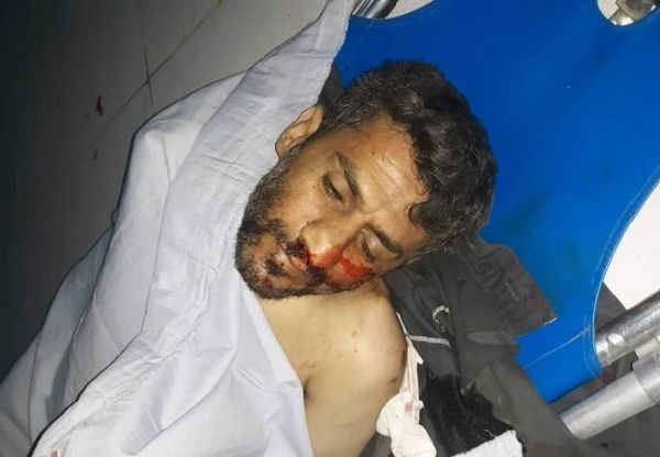 في ظل الفوضى الأمنية.. مقتل مواطن برصاص مسلحين حوثيين شمال صنعاء