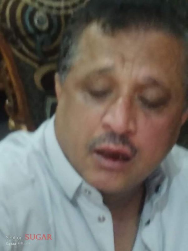 الصحفي الصمدي ينشر "صوراً" توضح الاعتداء عليه من عناصر حوثية في صنعاء
