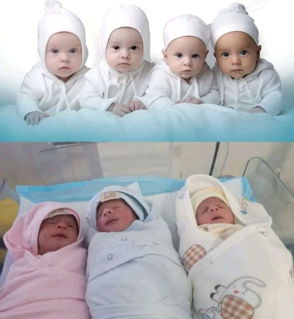 حدثان طبيان نادران في صنعاء.. ولادة ثلاثة توائم طبيعيًا وأربعة توائم خُدجًا في يوم واحد