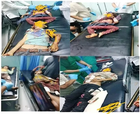 الضالع.. استشهاد 4 أطفال وجرح 9 آخرين بانفجار مقذوف حربي