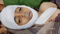 مركز حقوقي: تقرير الأمم المتحدة تجاهل الانتهاكات الحوثية الجسيمة بحق أطفال تعز