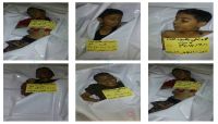 تحالف حقوقي: مقتل وإصابة أكثر من ألفي طفل برصاص الانقلابيين في تعز خلال 5 أشهر