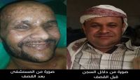 «أحمد».. مختطف لدى الحوثيين أصيب في قصف معسكر الشرطة العسكرية بصنعاء وترفض الميليشيا الافراج عنه