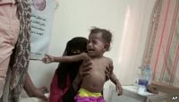 الموت جوعاً.. قصص مرعبة من اليمن الحزين