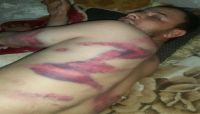 عصابة اجرامية تعتدي على مواطن بوحشية وسط صنعاء وتنهب مابحوزته من أموال