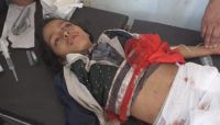 تعز: استشهاد 3 أطفال وإصابات خطرة لآخرين بقصف ميليشيات الحوثي حياً سكنياً