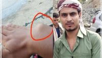 بدر سلطان.. مختطف سابق يكشف ما تعرض له من تعذيب وحشي في سجون "الحوثي"